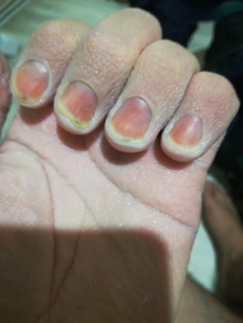 Могу ли я использовать специальные технологии для бесшумного сноса стены. В поисках тишины. Или шумоизоляция своими руками. 1