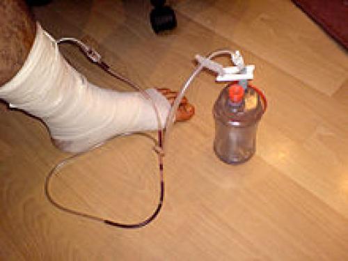 Как работают дренажные трубы. Цена 14